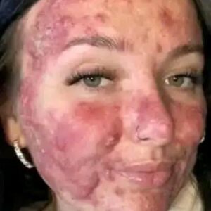 Her body was itchy, he thought it was an allergy, they diagnosed him with ca…see more